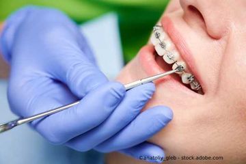 Behandlung bei Zahnarzt Praxis Christian Eis