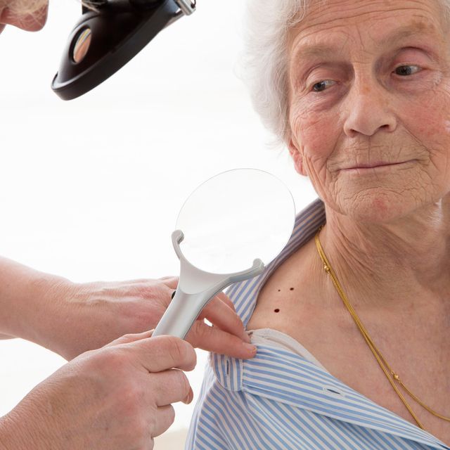 Una anciana está siendo examinada por un médico con una lupa.