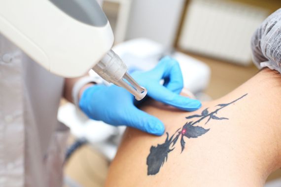 Machine à tatouer appliquant un tatouage floral noir sur la peau, mains gantées dans un studio