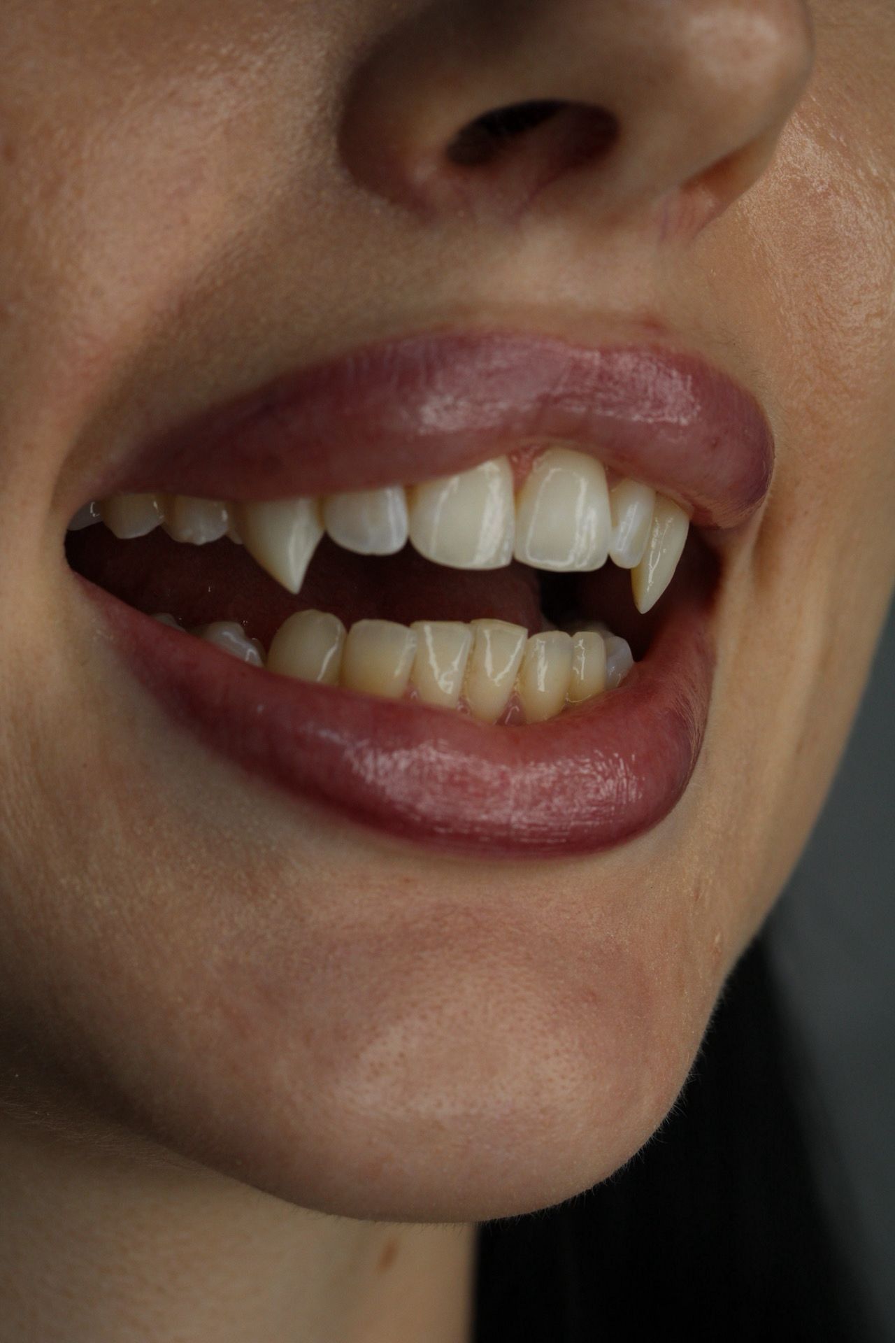 Primer plano de una boca sonriente con los labios entreabiertos, dejando ver los dientes y los caninos.