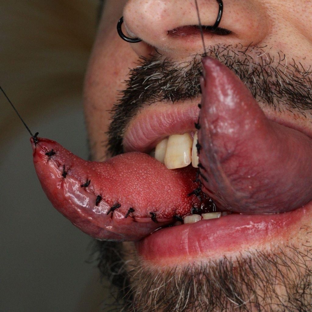 Primer plano de una persona con un piercing negro en la nariz y la lengua partida y cosida, que sobresale de la boca.