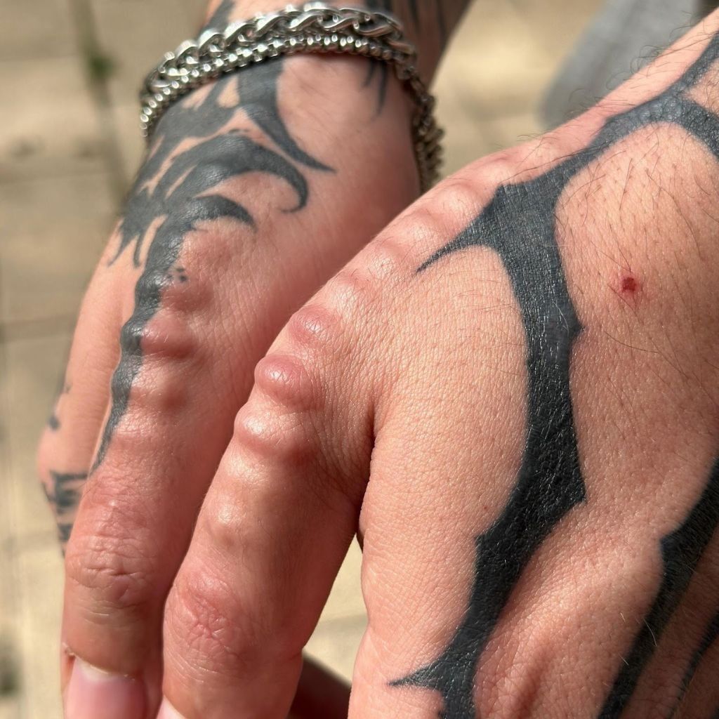 Manos tatuadas con una pulsera de cadena plateada, donde se aprecia un pequeño arañazo rojo en un nudillo.