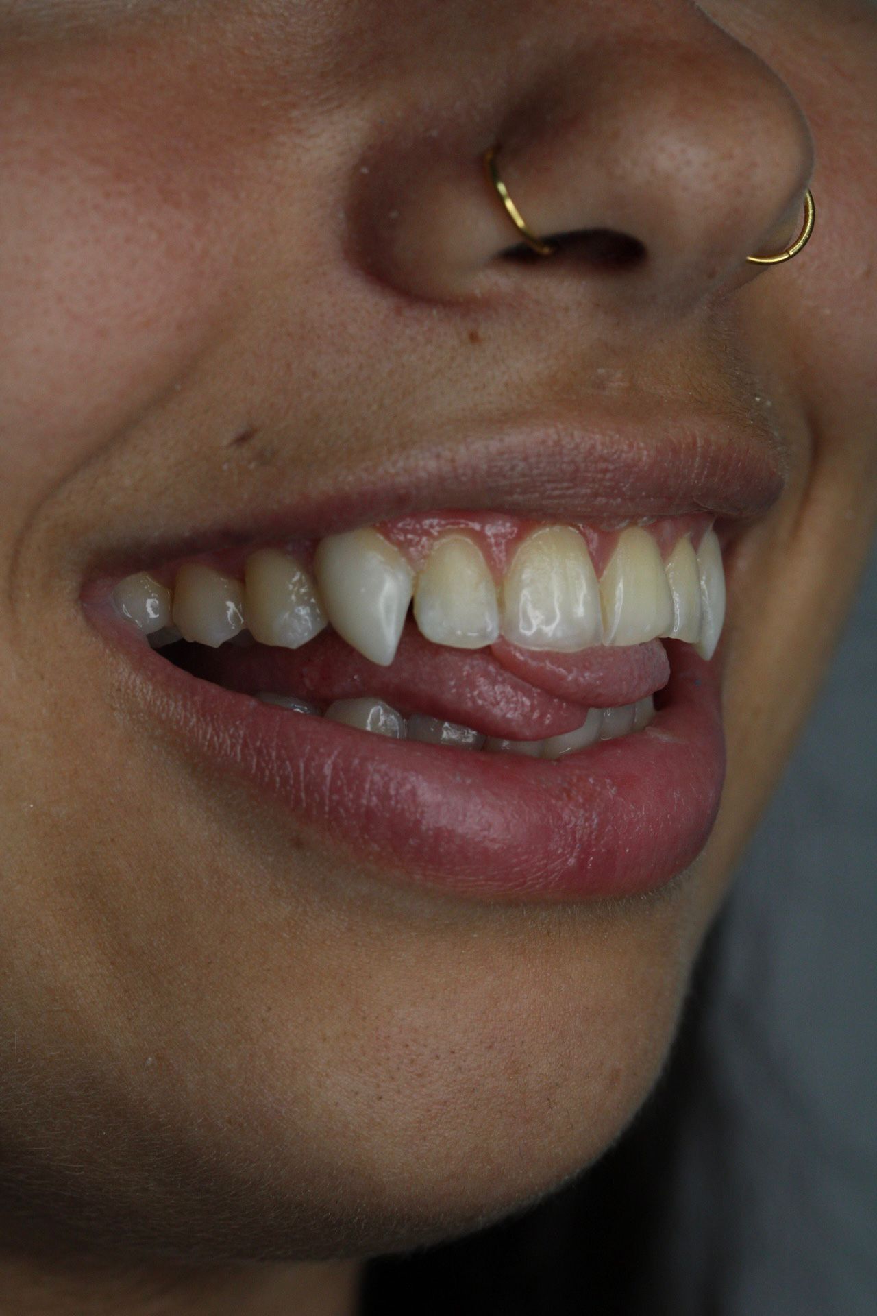 Primer plano de una boca sonriente con la lengua tocando los dientes frontales y un piercing de oro en la nariz.