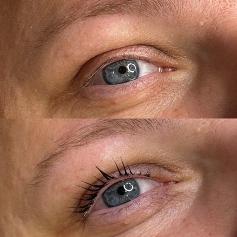 Remplacement de cils avant après