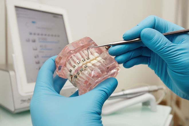 Primer plano de una persona en el dentista con la boca abierta mientras un espejo dental examina sus dientes.