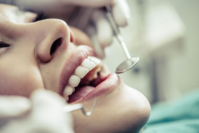 Primer plano de una persona en el dentista con la boca abierta mientras un espejo dental examina sus dientes.