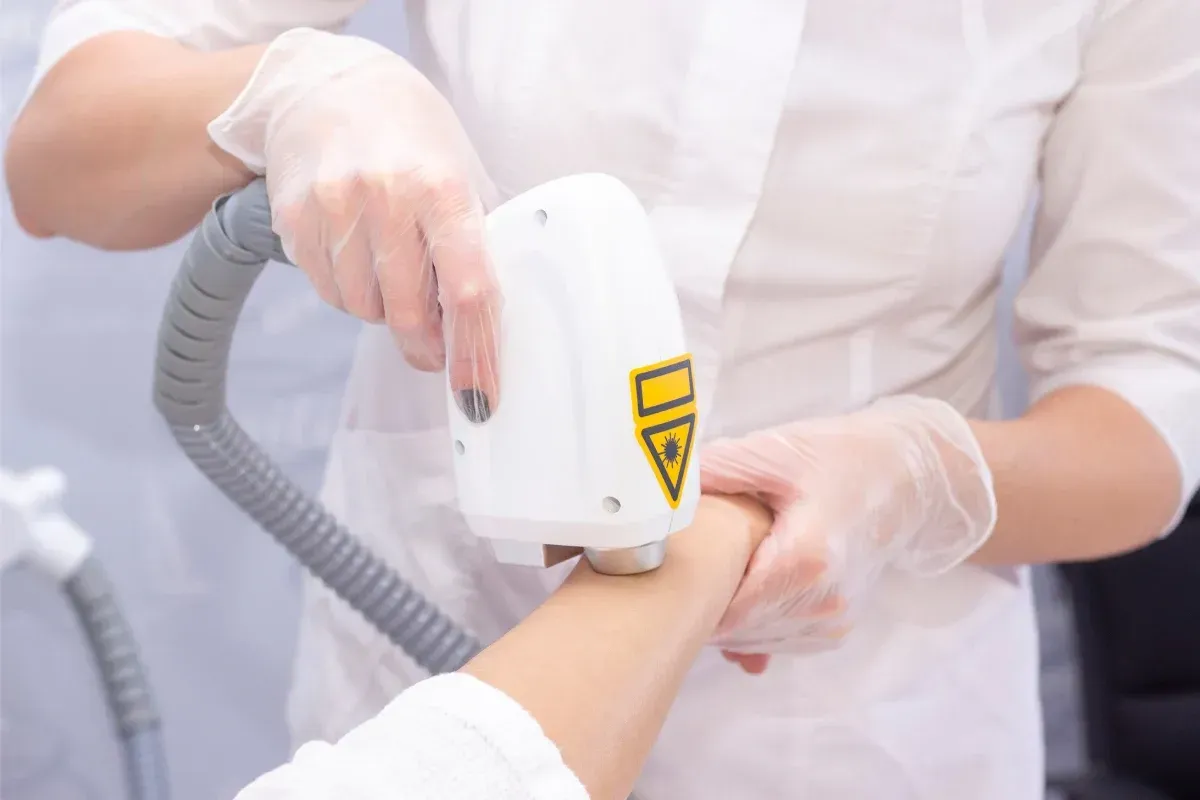 Persona con guantes que utiliza un dispositivo de depilación láser en el brazo de un paciente en un entorno clínico.