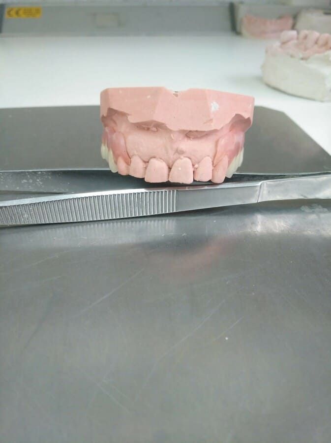 Un modelo dental está sentado encima de un par de pinzas.
