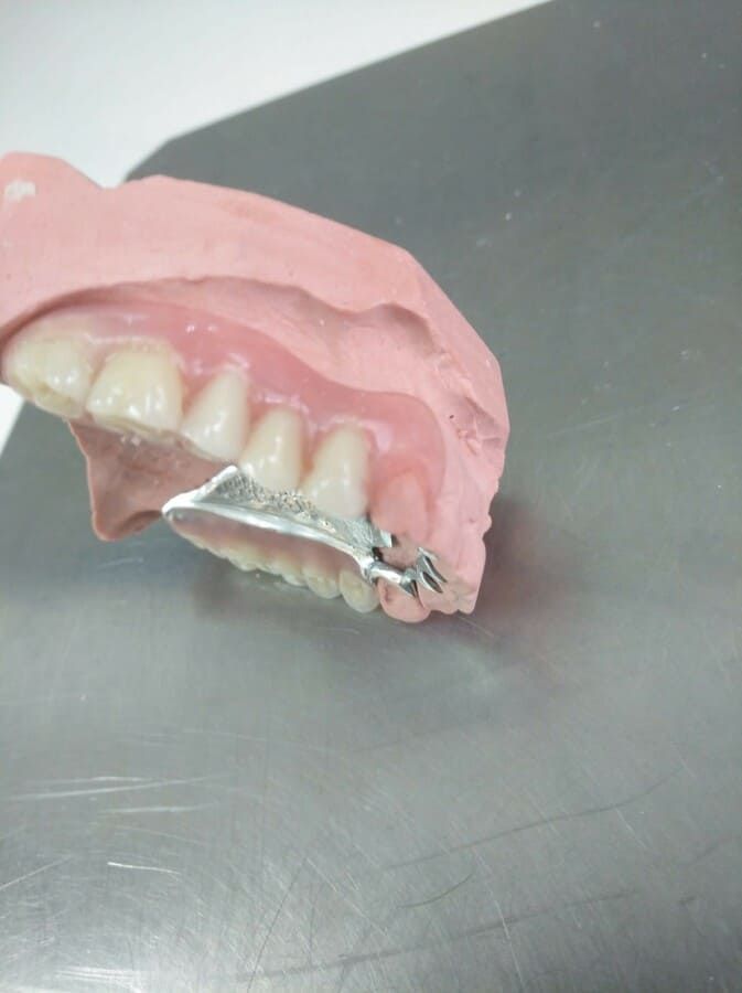 Un primer plano de una dentadura postiza sobre una superficie metálica.
