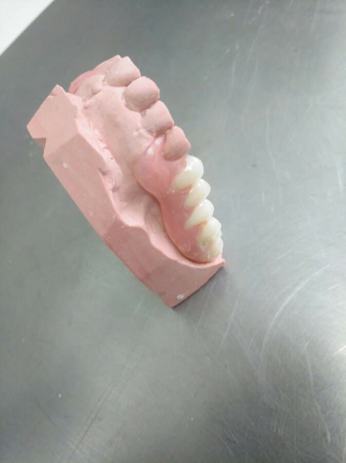 Un modelo de los dientes de una persona está sentado sobre una mesa.