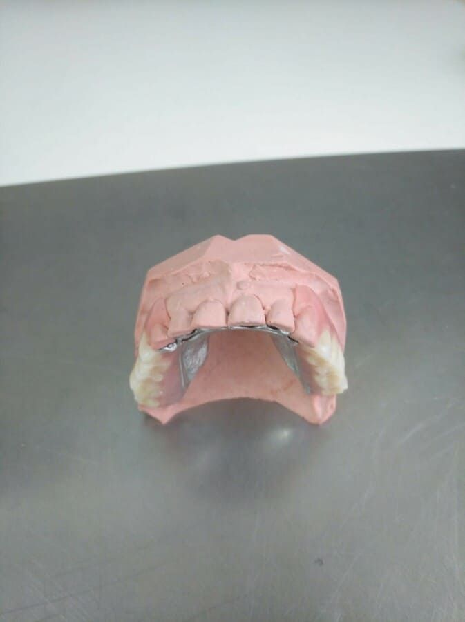 Un modelo de los dientes de una persona está sentado sobre una mesa.