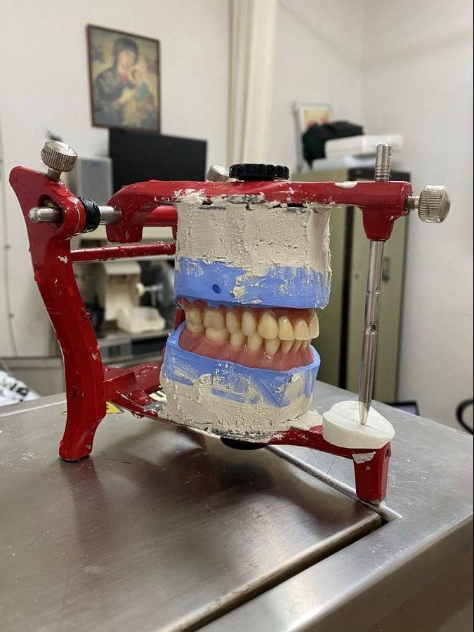 Un modelo de los dientes de una persona está sentado sobre una mesa.