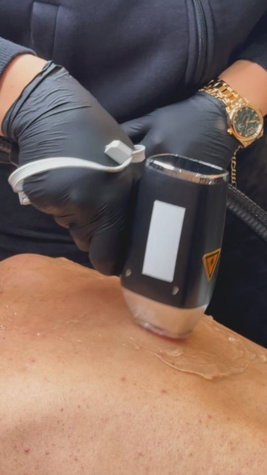 Ein mit Handschuhen bekleideter Therapeut verwendet während einer Behandlungssitzung ein Handgerät am unteren Rücken eines Patienten.