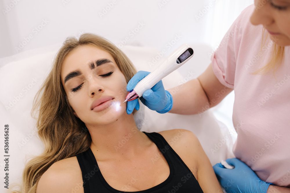 Eine Frau bekommt eine Laserbehandlung im Gesicht.