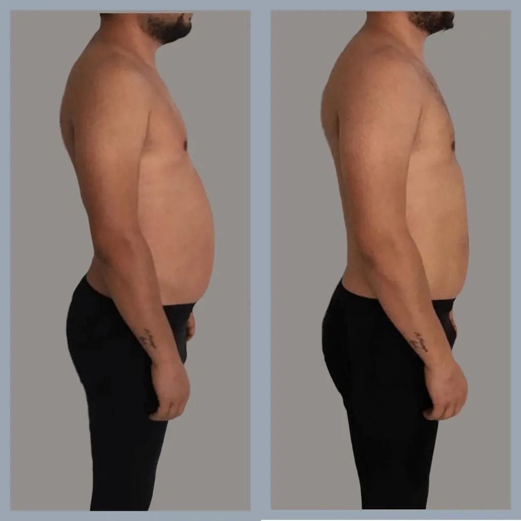 Comparaison côte à côte du torse d'une personne. La personne a un ventre plus marqué sur la photo de gauche.