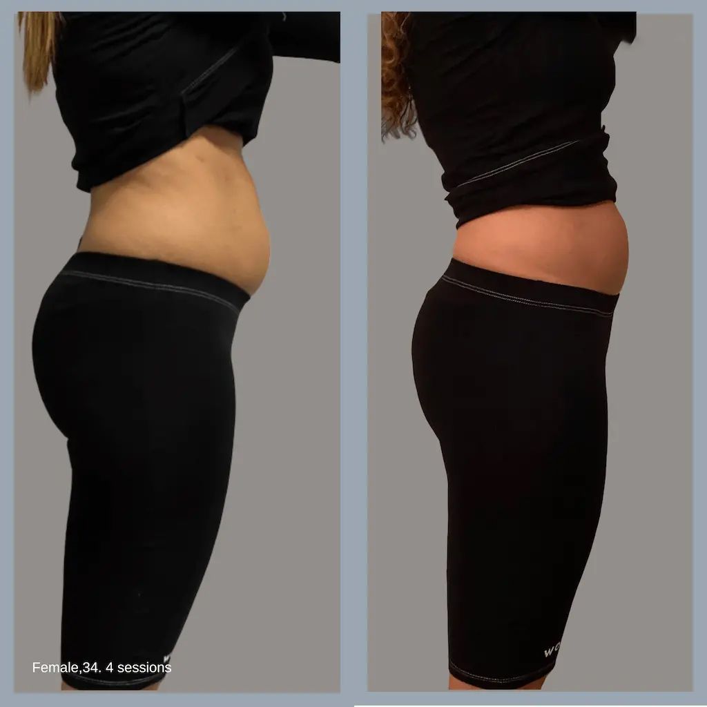 Deux photos de profil montrent le torse d'une personne. À gauche : avant. À droite : après. Vêtue d'une tenue de sport noire, elle a un ventre plat.