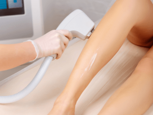 Una mujer está recibiendo un tratamiento de depilación láser en las piernas.