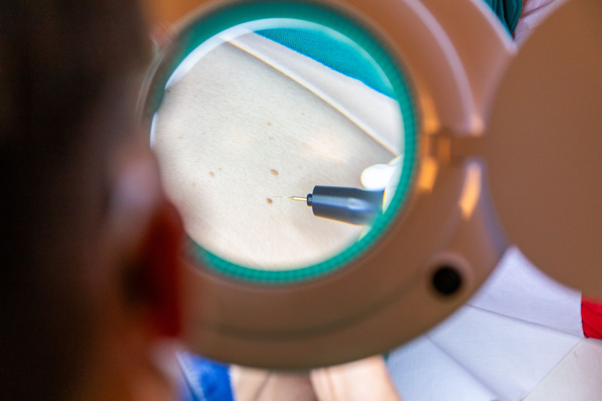 Betrachtung durch eine Lupe.