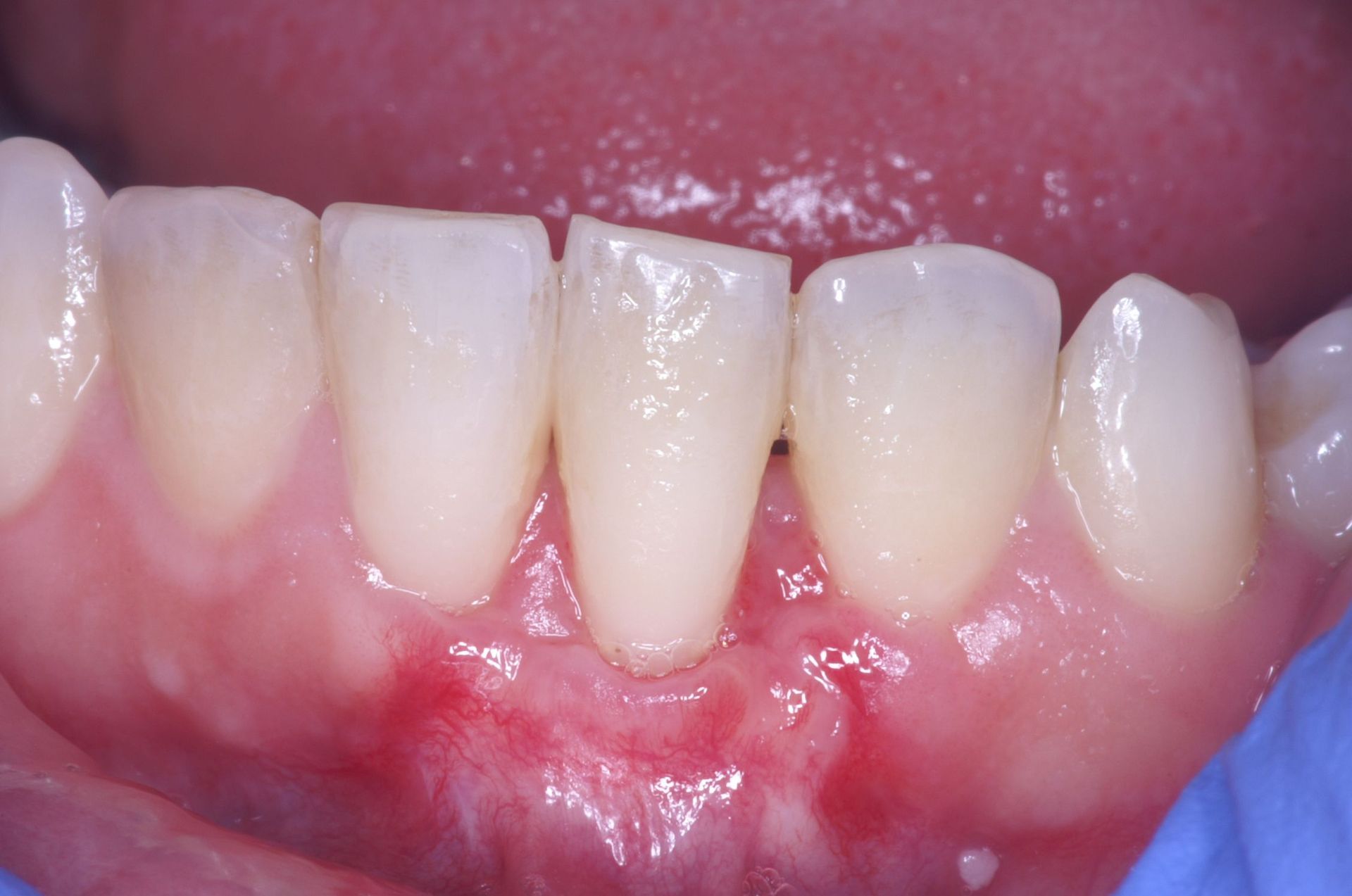 Dr Jean-Daniel Portigheis