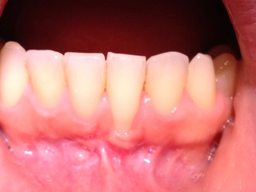 Dr Jean-Daniel Portigheis