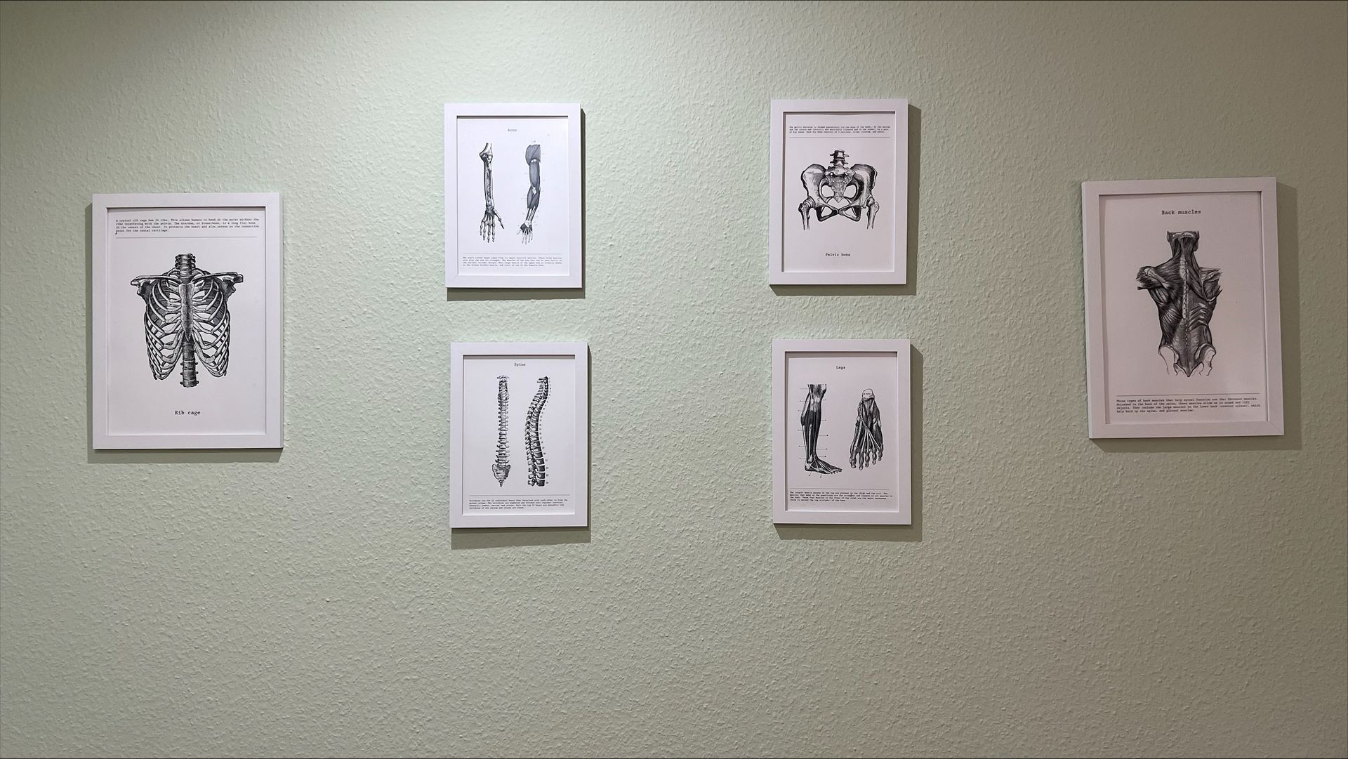 Wandbilder Physiotherapie