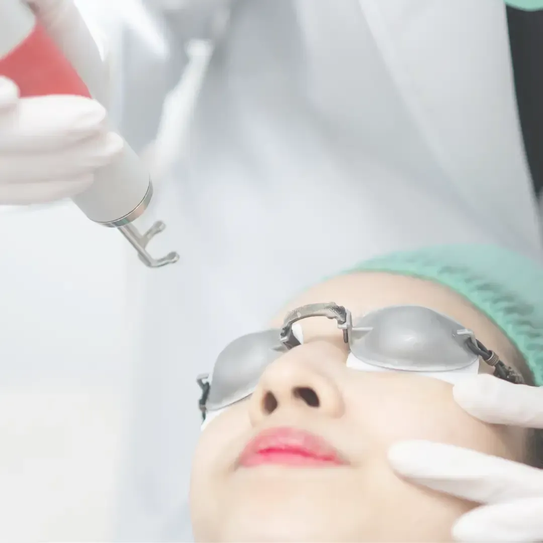 Una persona recibe tratamiento ocular con láser, con gafas protectoras, en un entorno clínico. Una mano enguantada sostiene el dispositivo láser cerca de la cara.