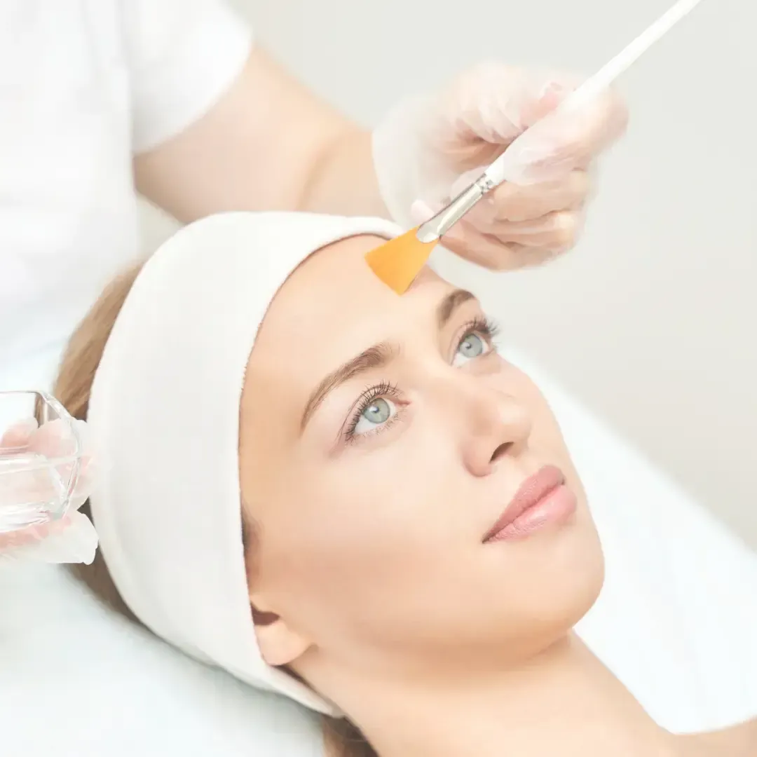 Mujer recibiendo una exfoliación química facial. Un profesional con guantes aplica una solución química en la frente con un cepillo.
