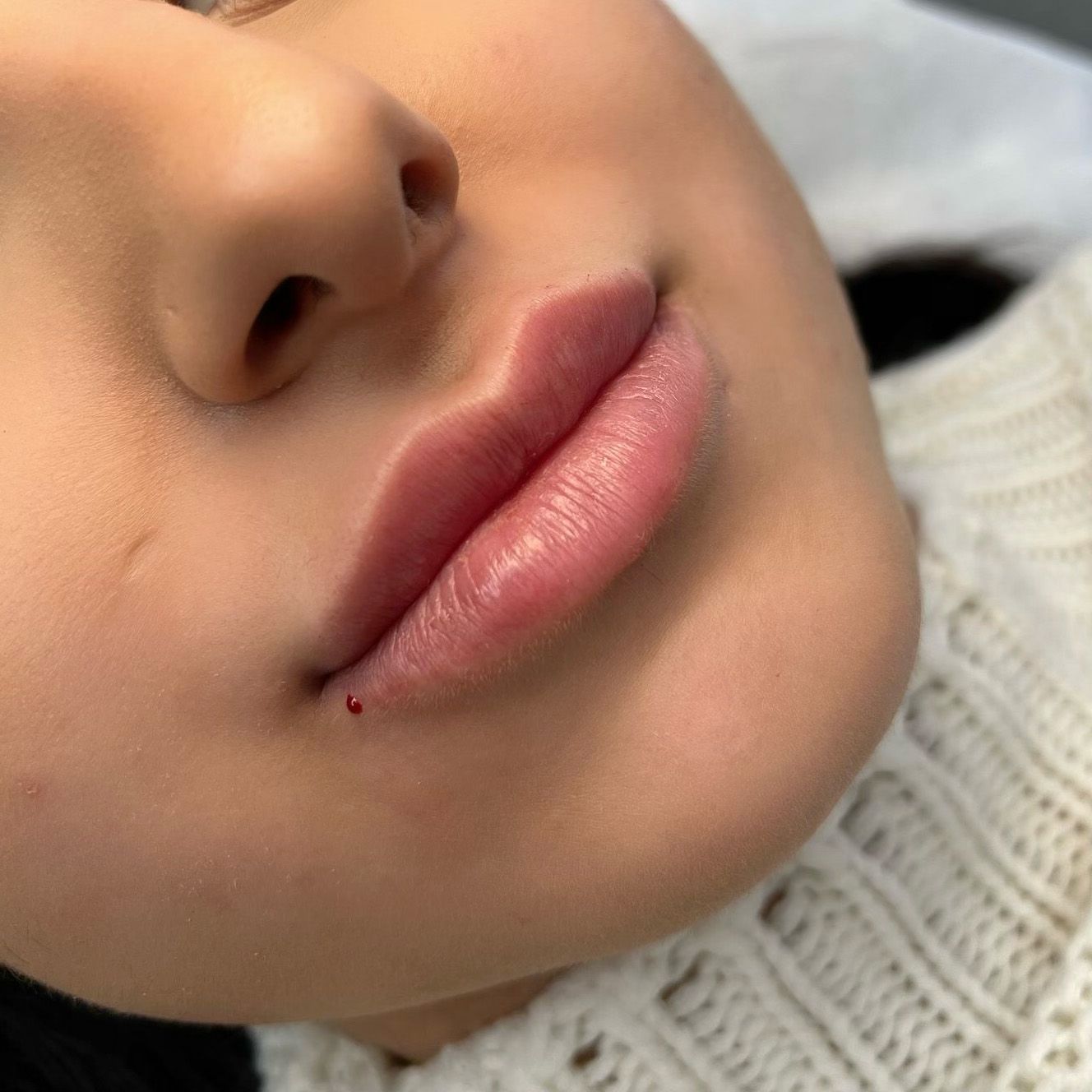 Eine Nahaufnahme der Lippen und Nase einer Frau.