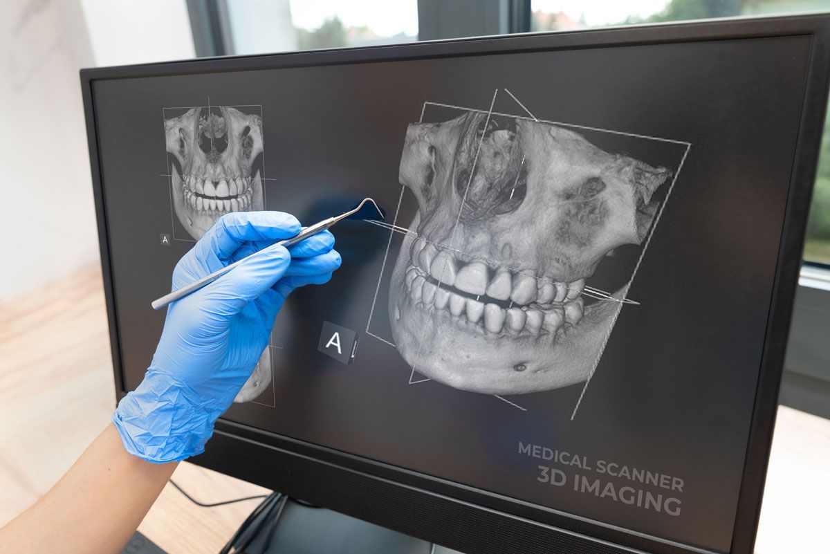 Un dentista está examinando los dientes de un paciente en una pantalla de computadora.