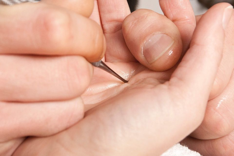 Spitzer Gegenstand auf Handinnenfläche