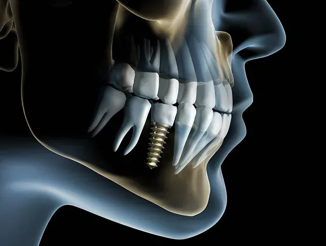 Un primer plano de los dientes de una persona con un tornillo en ellos.