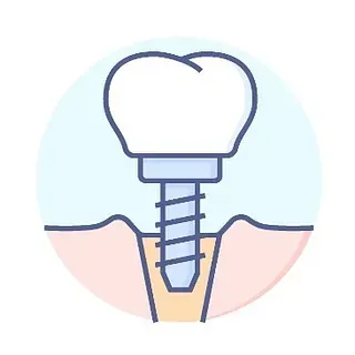 Un icono de un implante dental en un diente.