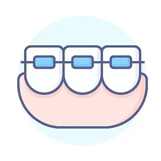 Una ilustración de dibujos animados de los dientes de una persona con frenillos.