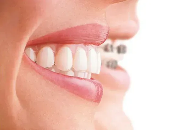 Un primer plano de la boca de una mujer con dientes blancos y labios rosados.