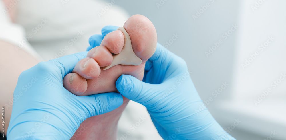 Behandschuhte Hände untersuchen vorsichtig den Fuss eines Babys in einer klinischen Umgebung.