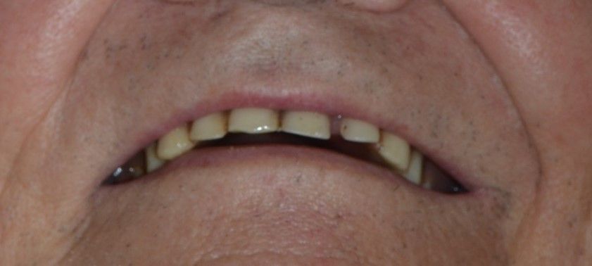 Eine Nahaufnahme der Zähne und des Mundes einer Person. Dentaltechnik Claudia Meier