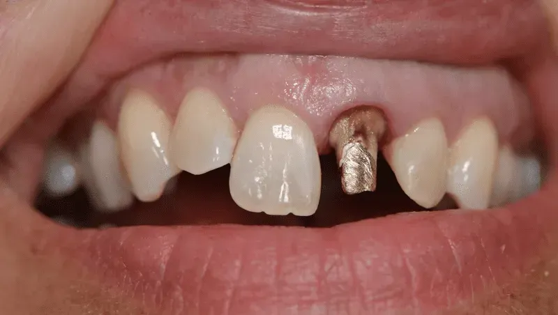 Eine Nahaufnahme der Zähne und des Mundes einer Person. Dentaltechnik Claudia Meier