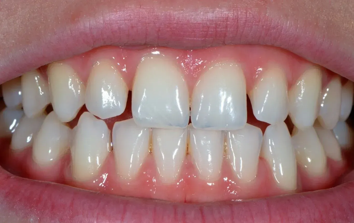 Eine Nahaufnahme der Zähne und des Mundes einer Person. Dentaltechnik Claudia Meier