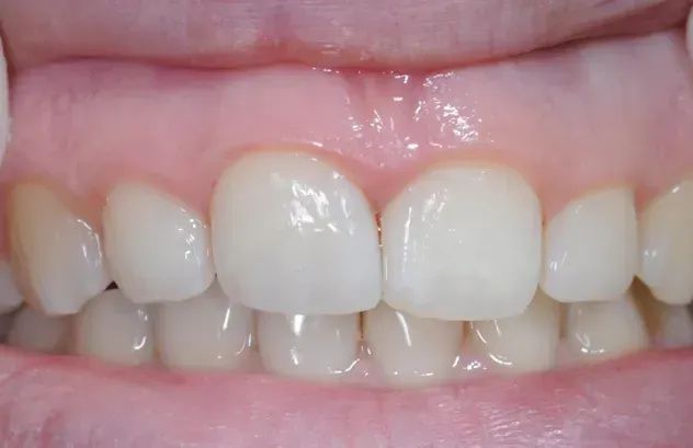 Eine Nahaufnahme der Zähne und des Mundes einer Person. Dentaltechnik Claudia Meier