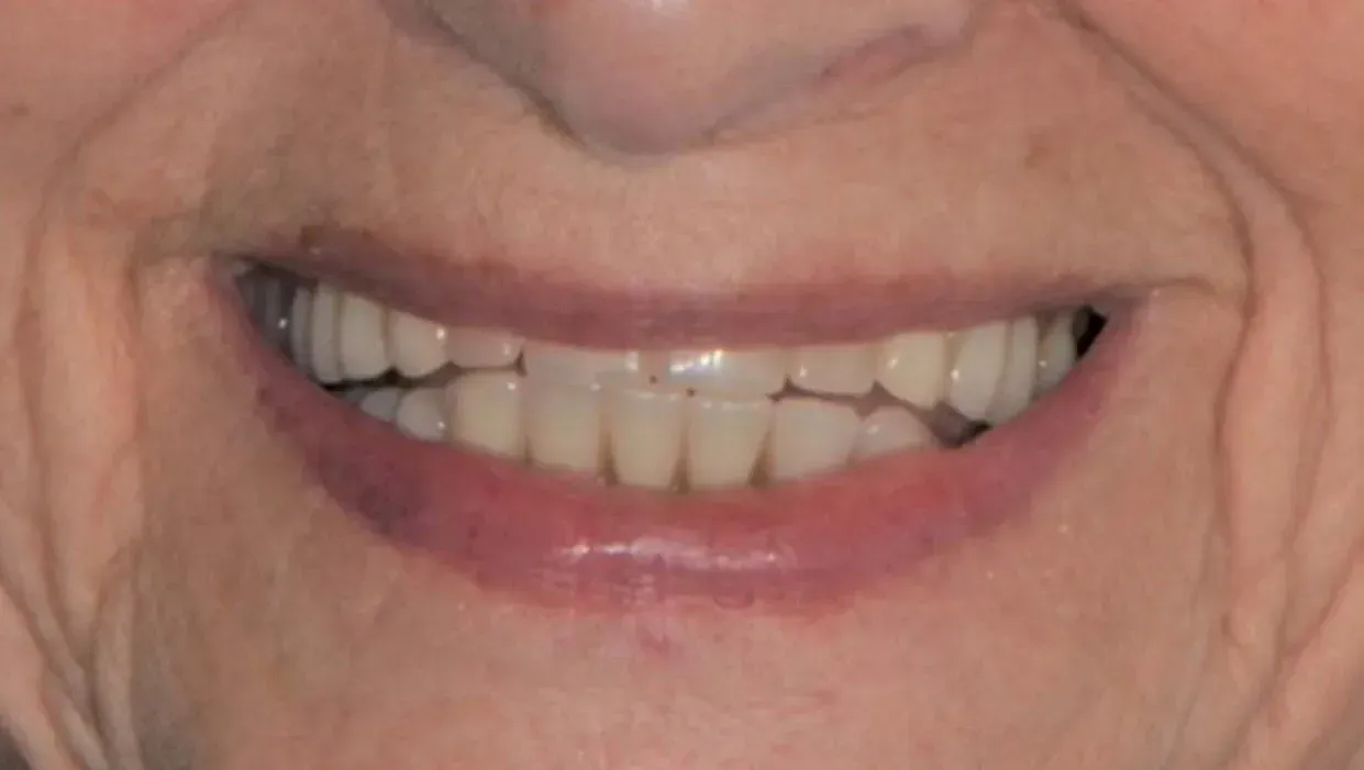 Eine Nahaufnahme der Zähne und des Mundes einer Person. Dentaltechnik Claudia Meier