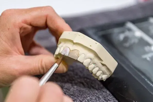 Ein Zahnarzt arbeitet an einem Modell der Zähne einer Person. Dentaltechnik Claudia Meier