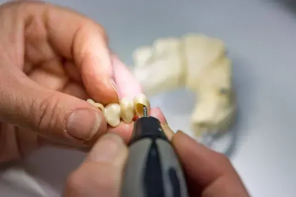 Ein Zahnarzt bearbeitet mit einer Schleifmaschine ein Zahnmodell. Dentaltechnik Claudia Meier