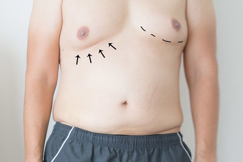 Un hombre sin camisa tiene flechas dibujadas en el pecho.