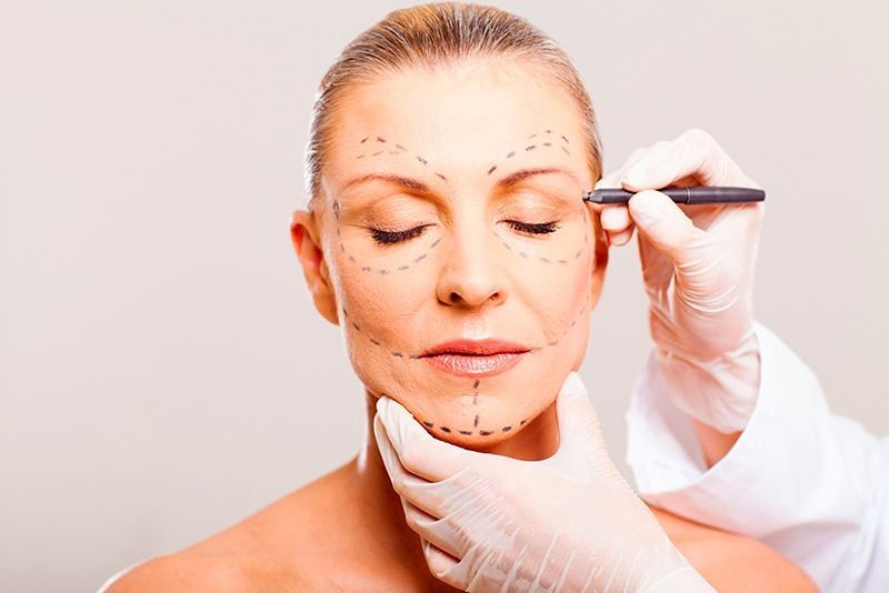Una mujer se está haciendo una cirugía estética en la cara.