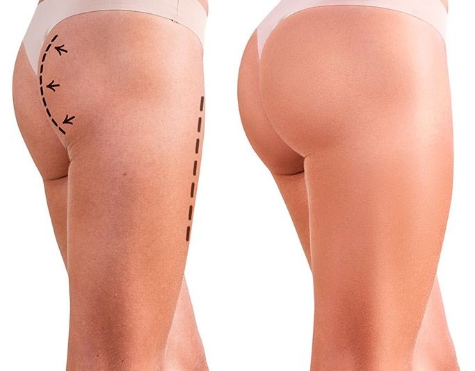 piernas