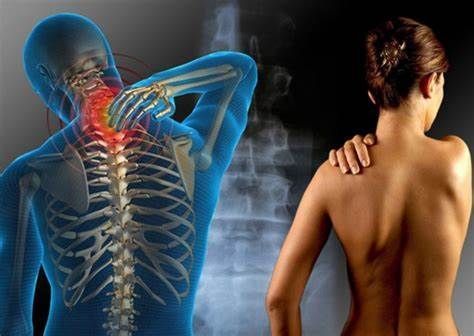 Una mujer se sostiene el hombro con dolor al lado de un esqueleto.