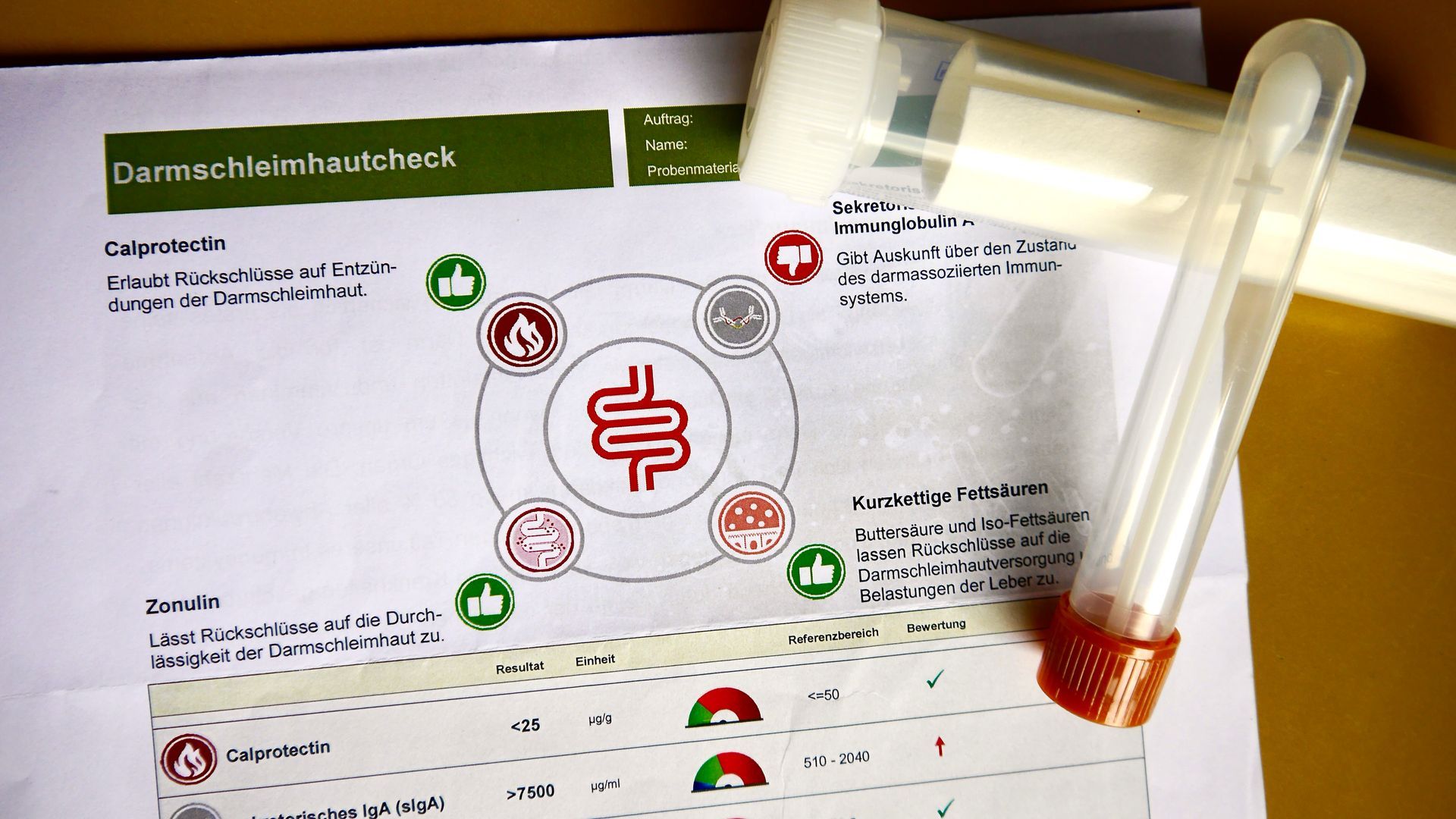 Auf einem Blatt Papier neben einem Reagenzglas befindet sich die Zeichnung eines Magens.