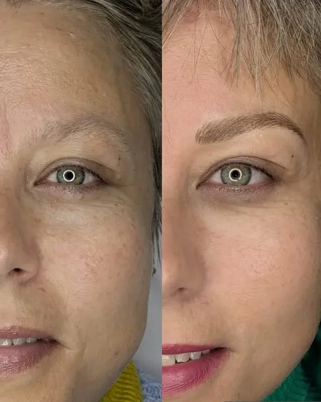 Una fotografía de antes y después del rostro de una mujer con y sin cejas.