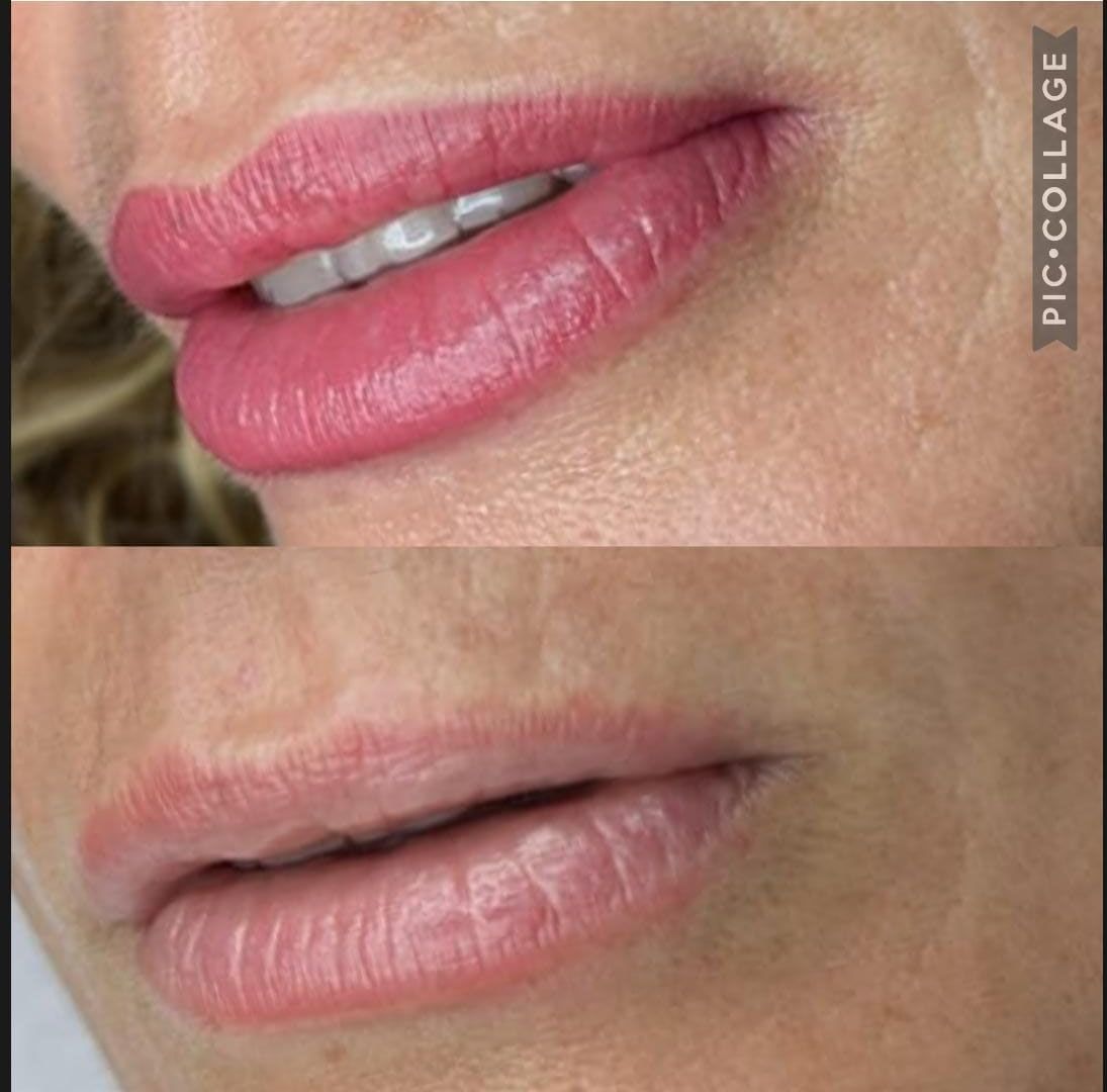 Una foto de antes y después de los labios de una mujer con lápiz labial rosa.