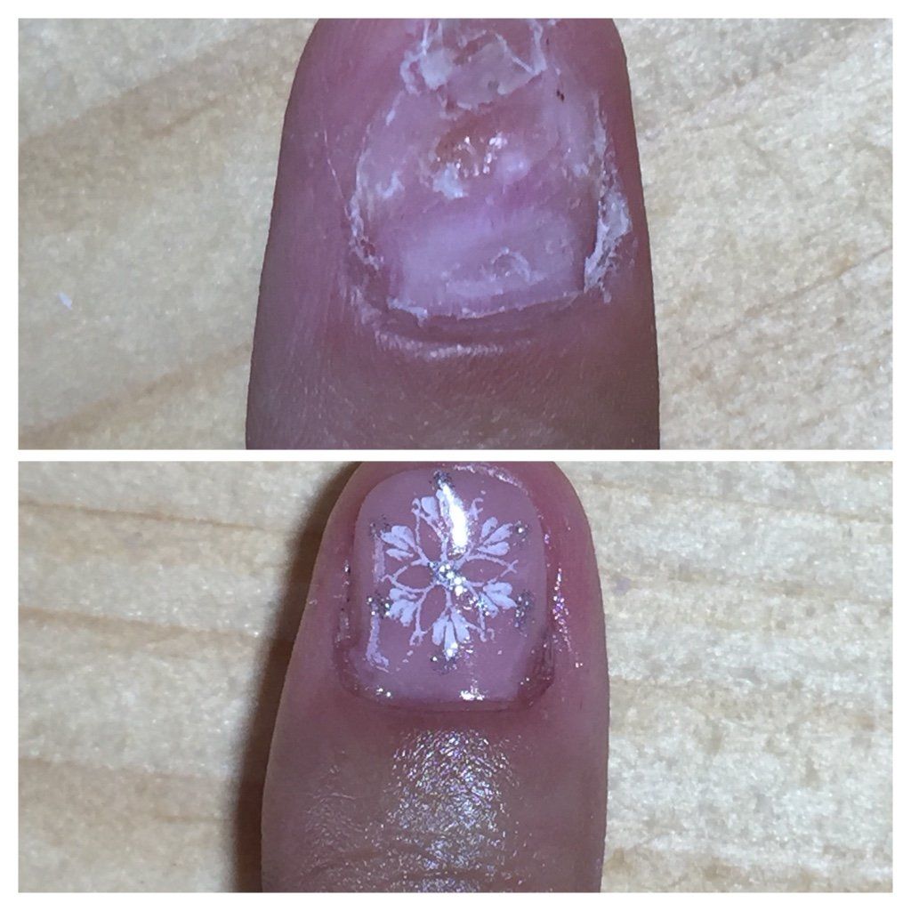 Création de l'ongle (avant - après)